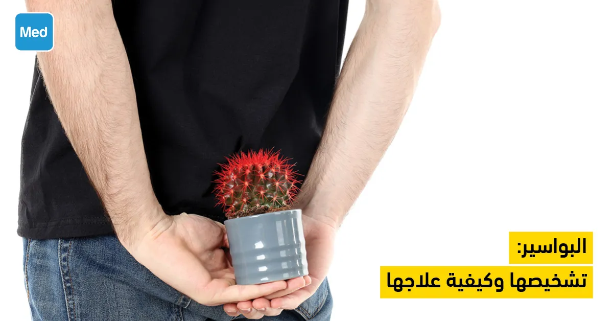 البواسير : تشخيصها وكيفية علاجها